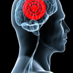Brain Inflammation and Autism