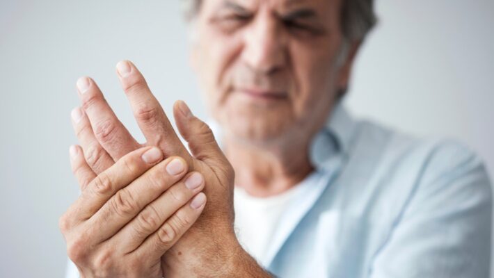 Psoriatic Arthritis: Understanding the Immune Connection Between Skin and Joints