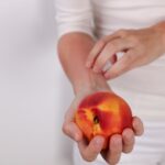 Histamine Intolerance: When Your Body Has More Histamine Than It Can Handle
