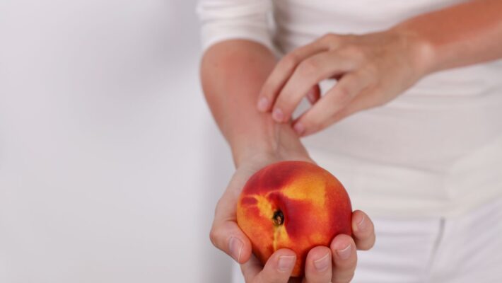 Histamine Intolerance: When Your Body Has More Histamine Than It Can Handle
