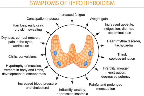 hyperthyroidism-insert | Sunrise Functional Medicine